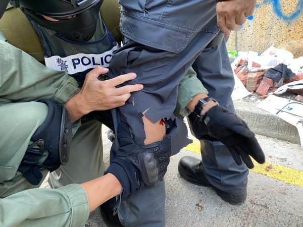 (홍콩 AP=연합뉴스) 홍콩의 홍콩이공대에서 17일 시위대가 쏜 화살이 한 경찰의 다리에 박히자 동료 경찰들이 이를 제거하려 하고 있다. 이 사진은 홍콩 경찰이 제공한 것이다.<br>