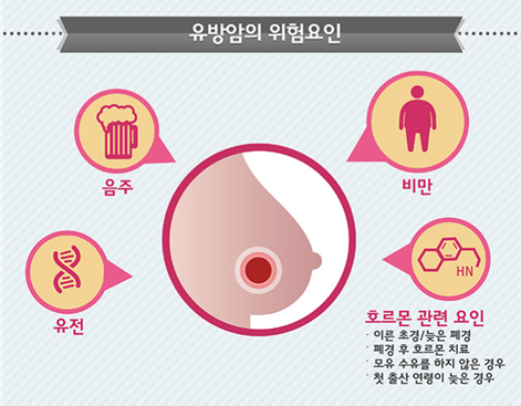 유방암의 위험요인/사진=국가암정보센터 홈페이지