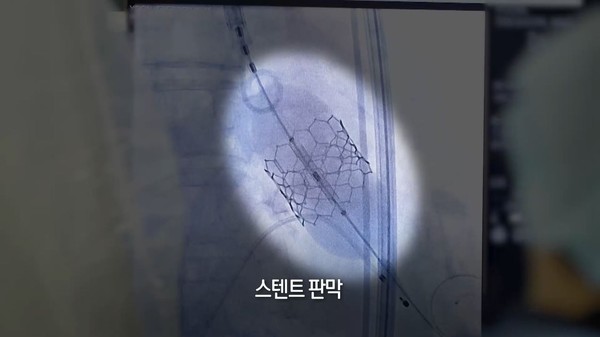 사진 = KBS '생로병사의 비밀' 제공