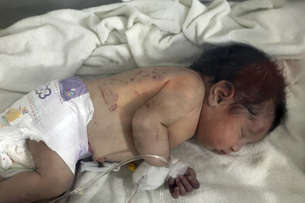 시리아 건물 잔해서 구조된 신생아, 건강 회복/AP, 연합뉴스 제공