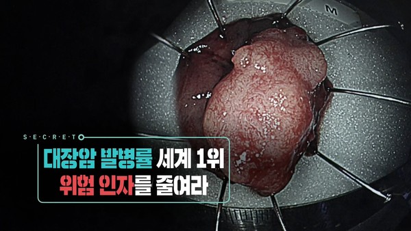 사진=KBS1TV '생로병사의 비밀‘