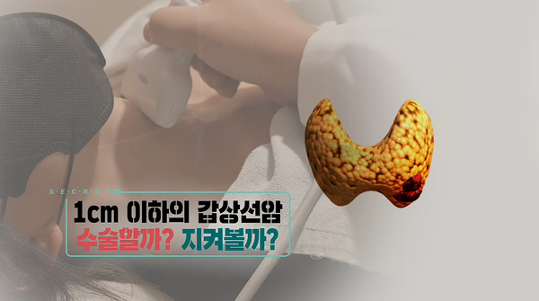 사진=KBS1TV '생로병사의 비밀' 제공 / '1cm 이하 갑상선암 수술할까? 지켜볼까?‘